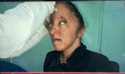 صندوق رعاية وتأهيل المعاقين يدين استهداف طفلة من ...